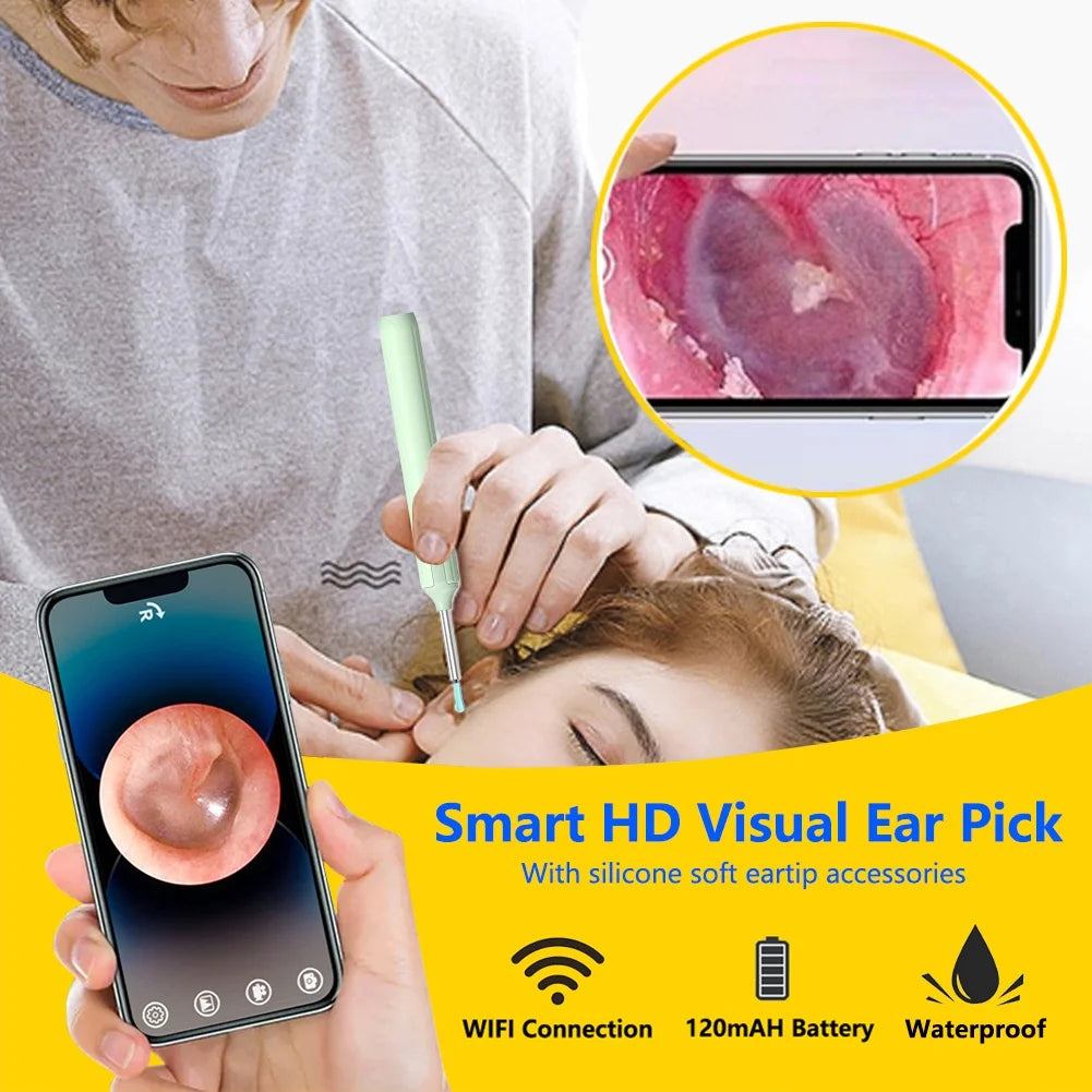 Ear Cleaner with 10 Pieces Earpicks, Ear Wax Removal Tool, 1296P HD Smart Visual Earwax Remove Kits 10Pcs Ear Tips Replacement (White)